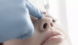 remodelage du nez sans chirurgie