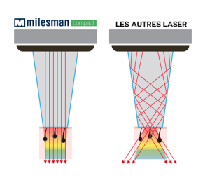 epilation definitive laser diode paris docteur chicheportiche